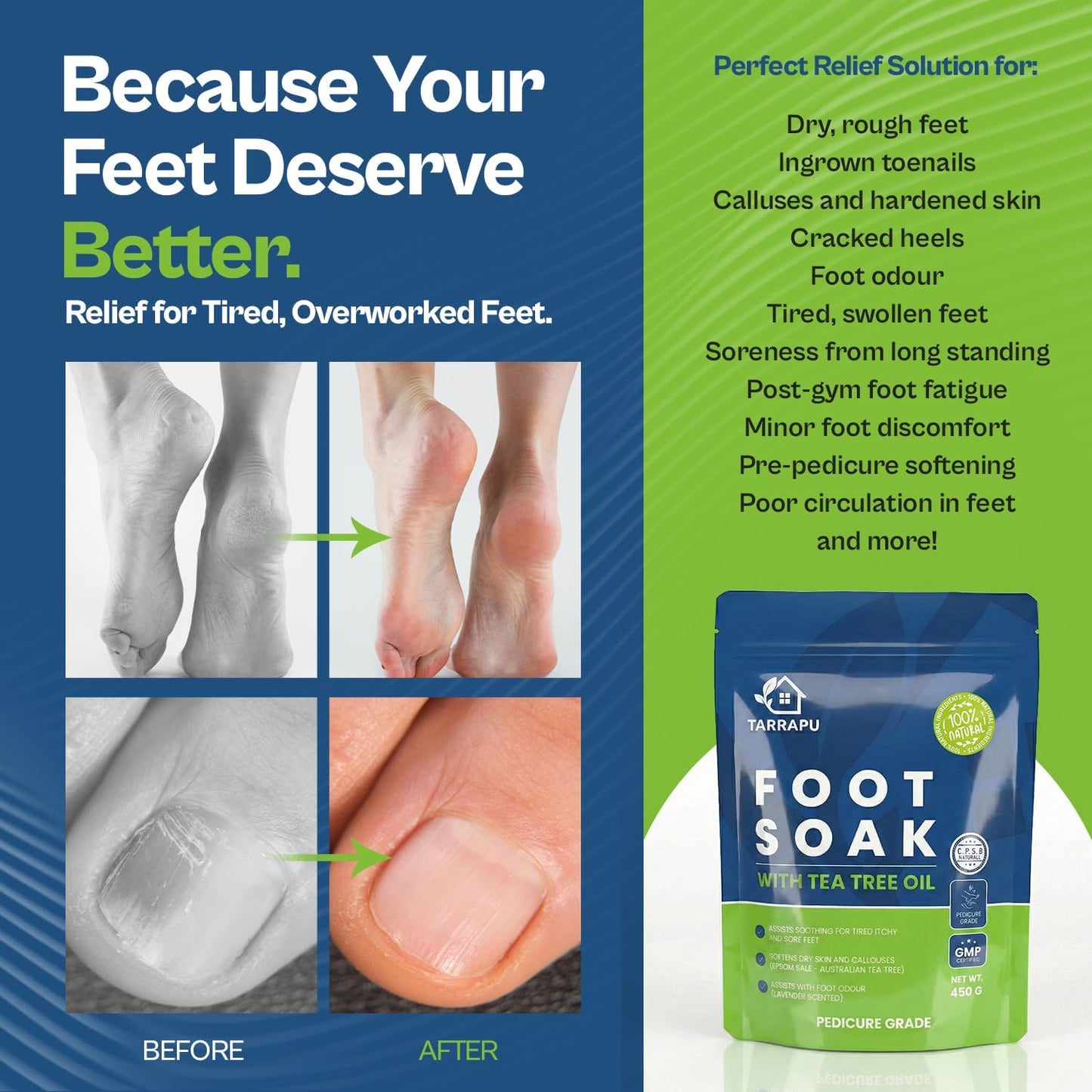 Why a Lavender‑Infused Foot Soak Might Just Be the Quiet Upgrade Your Routine Needs