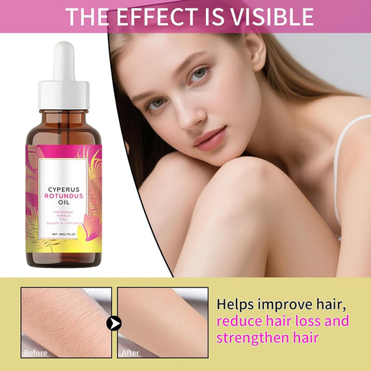 2PCS Cyperus Rotundus Oil, Natural Cyperus Rotundus Oil for Hair Removal, Inhibits Hair Growth, Reduces Body Unwanted Hair Growth, Moisturizes &amp; Soothes Skin, Hair Removal Oil for All Skin Types