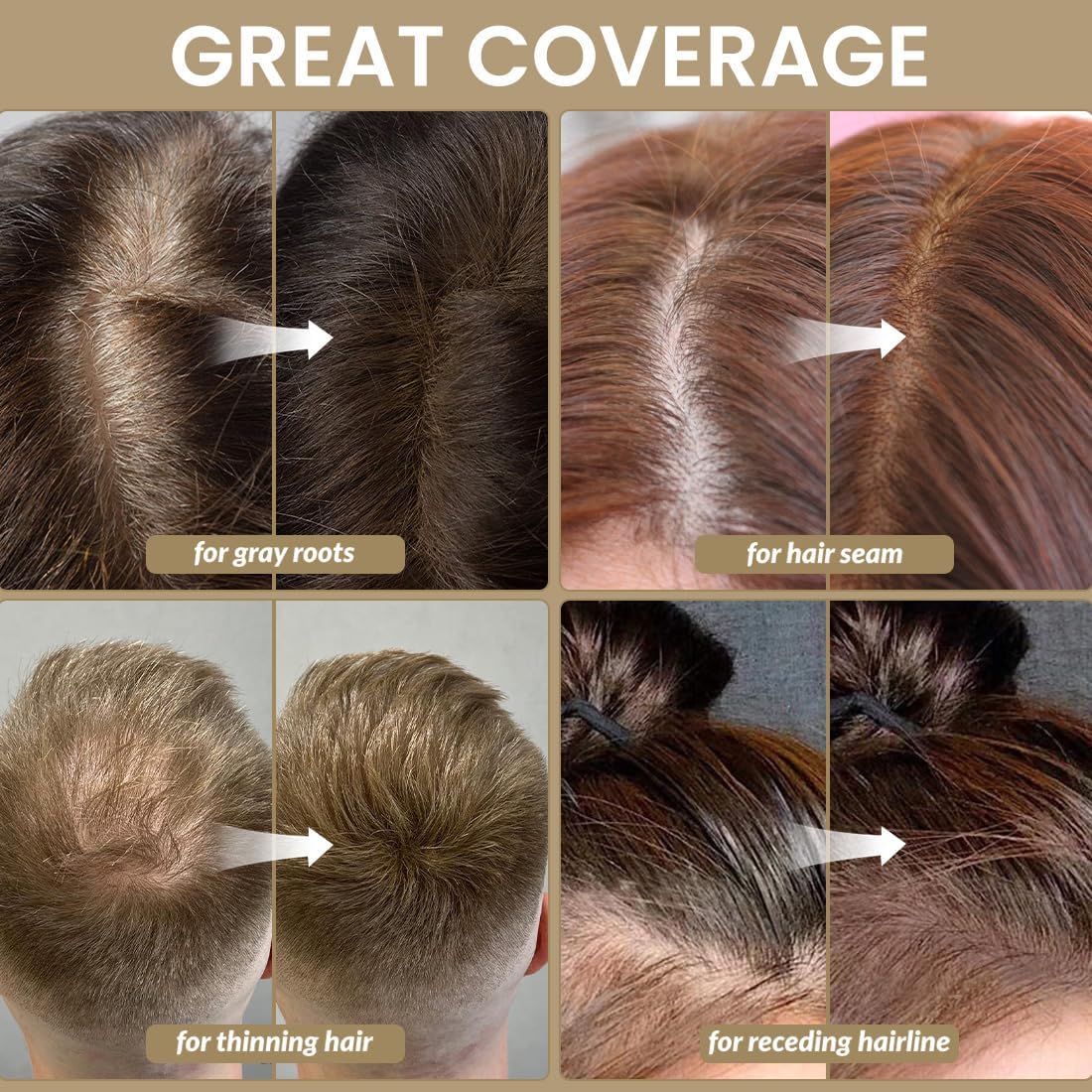 Root Touch up Powder 4g – Covers Grey Roots &amp; Conceals Thinning Hair, Hairline Powder for Men &amp; Women – Natural Look, Easy to Use &amp; Compact for Quick Touch Ups (Dark Brown)
