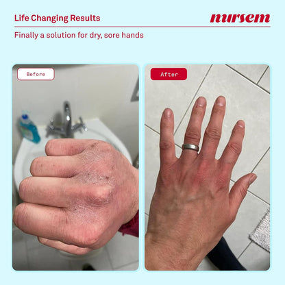 Nursem CARING HAND WASH – 300ml | Natural, ultra-gentle soap-free formula for very dry hands