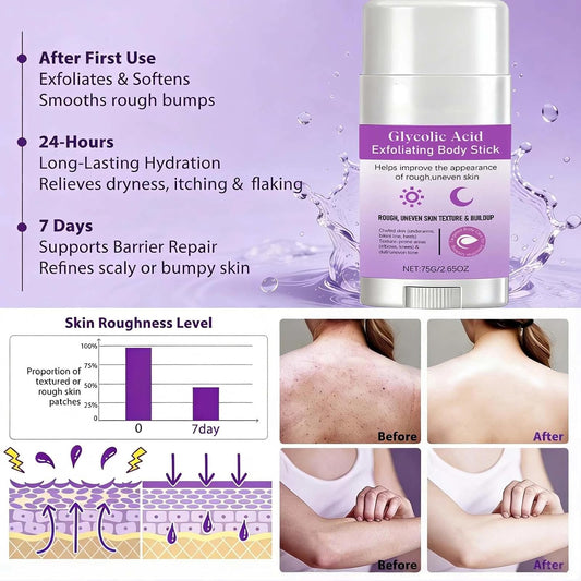 1PCS Glycolic Acid Exfoliating Body Stick, with 7% Glycolic &amp; 0.5% Salicylic Acid, AHA BHA Formula for Rough Skin, Keratosis Pilaris, Dark Spots &amp; Dry Patches Care
