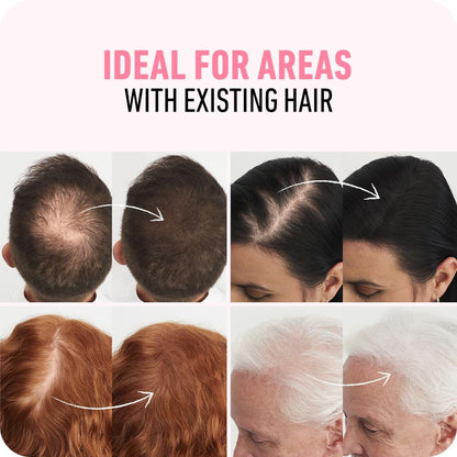 BOLDIFY Hair Fibers - Fill In Thinning and Fine Hair for an Instantly Fuller, Thicker Look - 14 Shades for Women &amp; Men