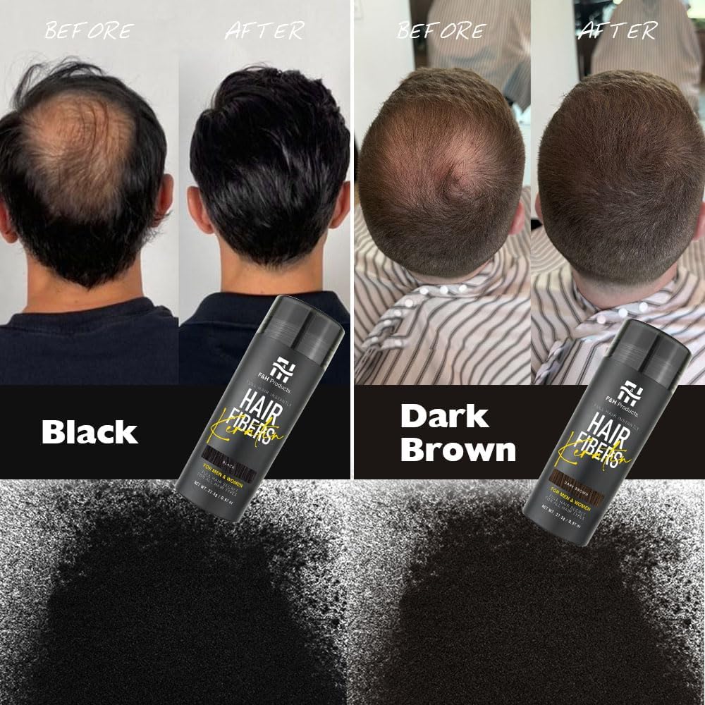 F&amp;H Hair Fibres Dark Brown 27.5g – Keratin Hair Building Fibers – Instant Hair Thickening Powder for Men &amp; Women