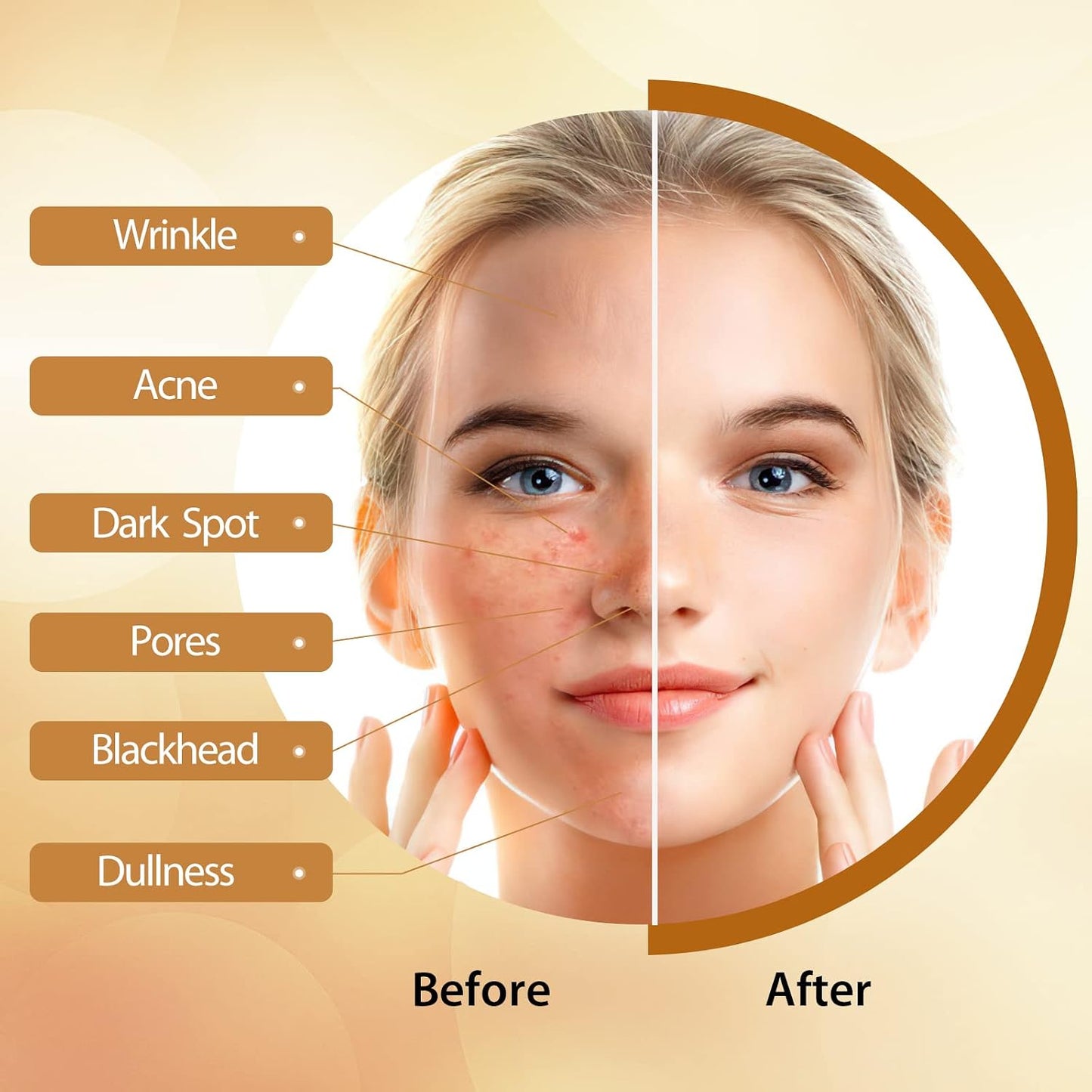 Kojic Acid Soap, with Turmeric &amp; Vitamins C, Dark Spot Remover for Face and Body, 100g x3 Moisturizing for Acne Blackheads Remover, Hyaluronic Acid for Deep Cleansing, with a Mesh Pouch
