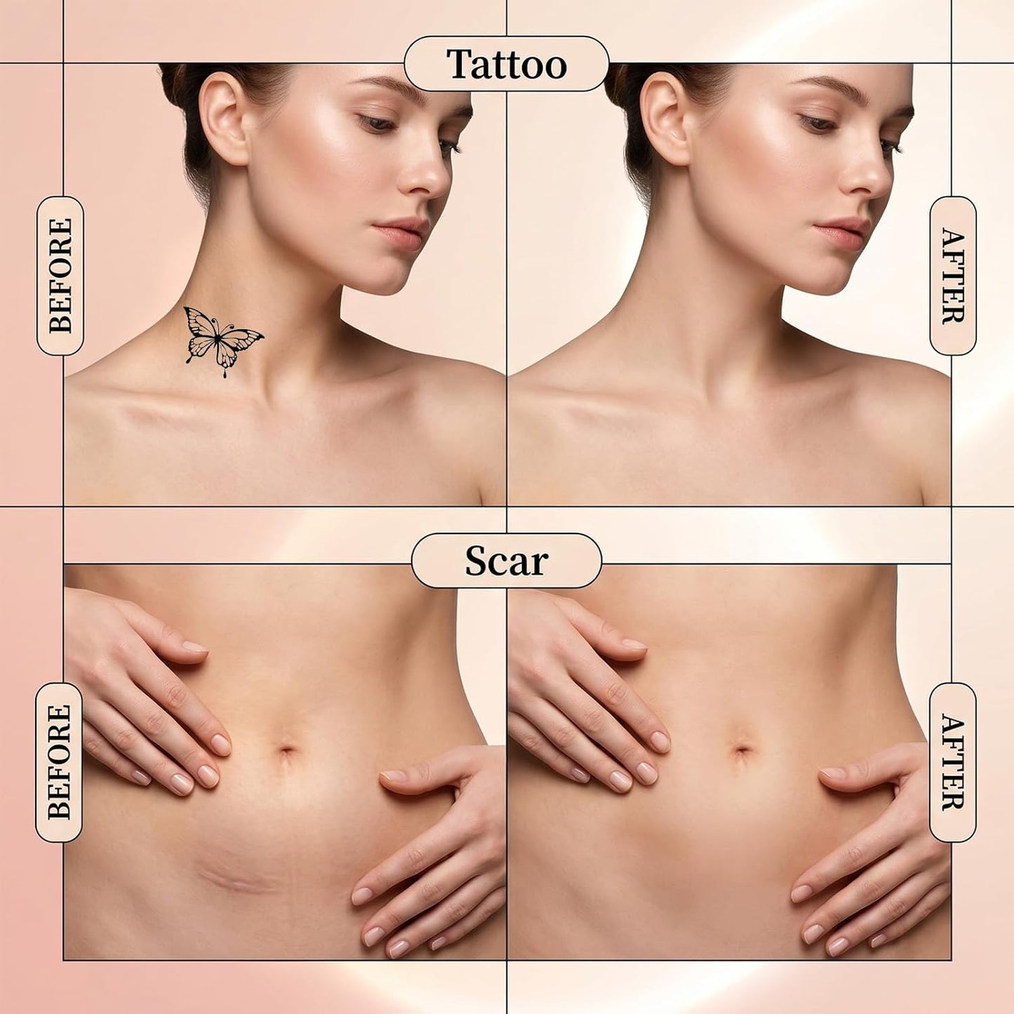 20 Pcs Tattoo Cover Up Patch, Thin Waterproof Tattoo Cover Up Tape for Body, Face, Arms