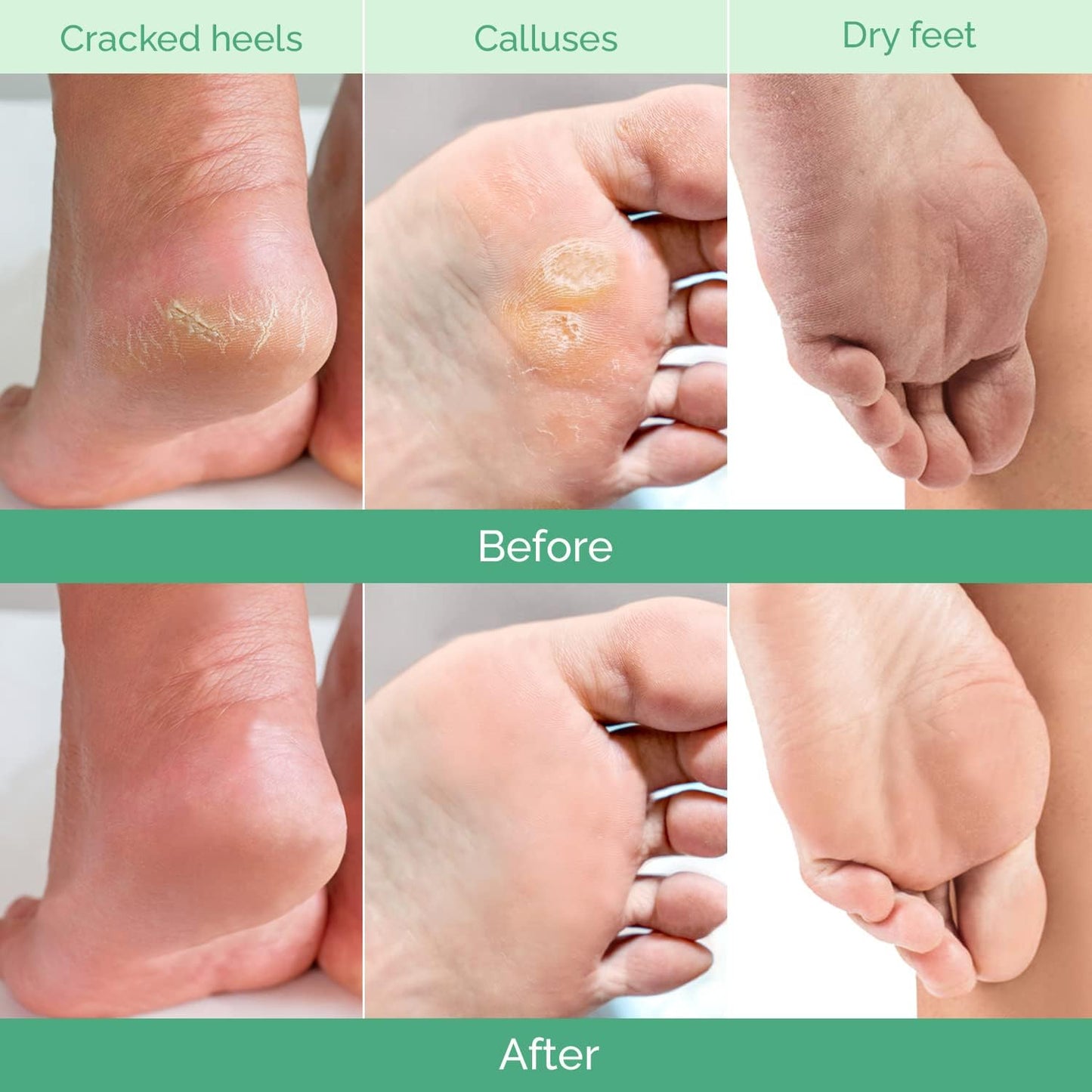 Soft‑Foot Solution You Can Slip On