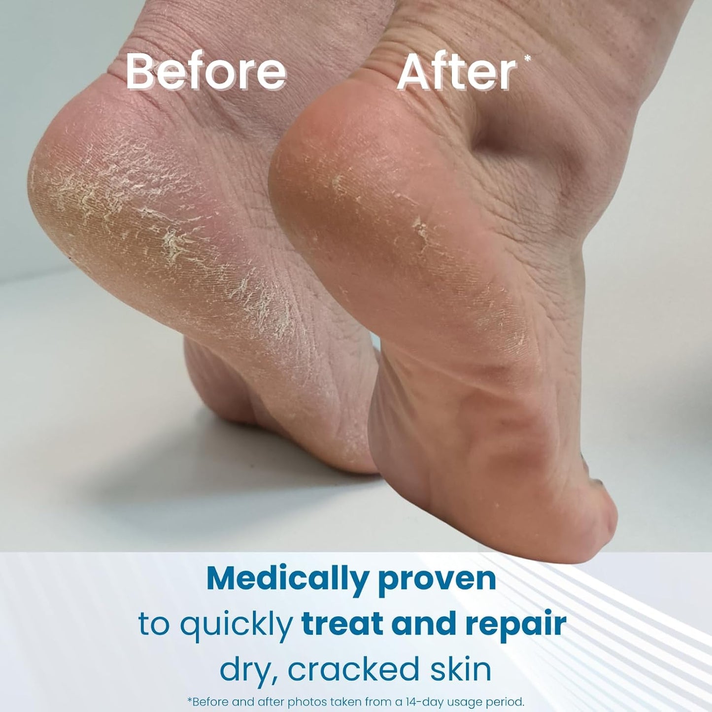 Why My Feet Finally Feel Like They Belong on a Beach