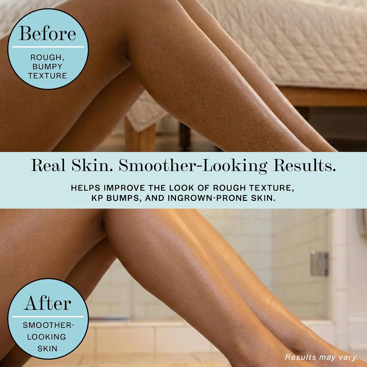 Base Laboratories Ingrown Hair - KP Bump Exfoliating Body Scrub - with AHA+BHA - Keratosis Pilaris Treatment - Daily Skin Exfoliant - Helps Reduce Strawberry Skin &amp; Razor Bumps - Men &amp; Women 90ml