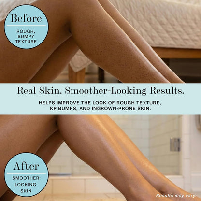 Base Laboratories Ingrown Hair - KP Bump Exfoliating Body Scrub - with AHA+BHA - Keratosis Pilaris Treatment - Daily Skin Exfoliant - Helps Reduce Strawberry Skin &amp; Razor Bumps - Men &amp; Women 90ml