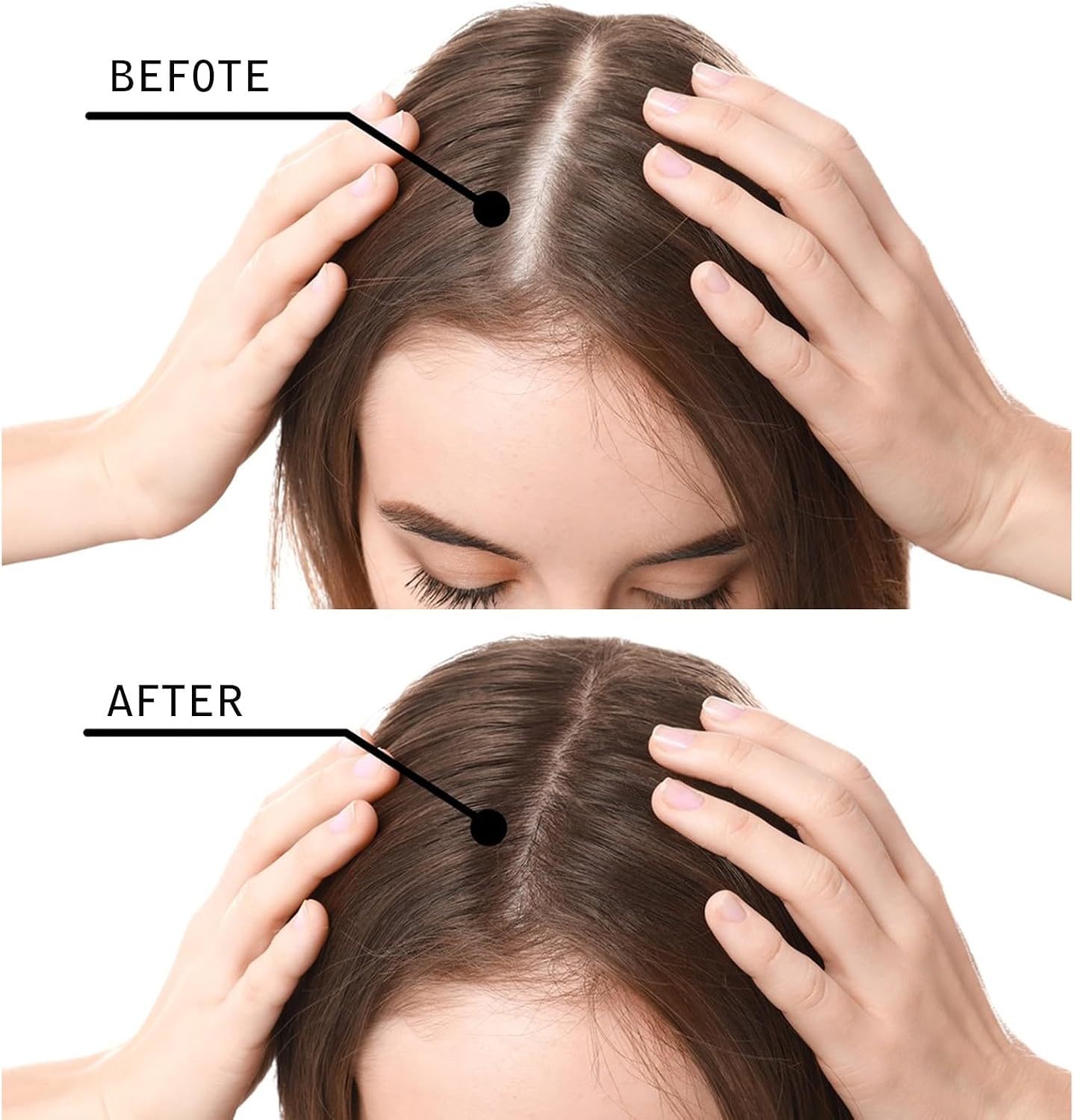 Hair Fibres,Hair Building Fibres &amp; Hair Fibres for Thinning Hair Instantly Undetectable &amp; Natural,Completely Conceals Hair Loss Hair Filler Hair Thickener &amp; Topper for Women Dark Brown