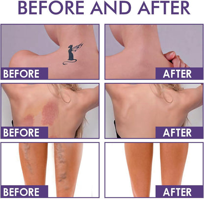 Body Coverage Perfector Waterproof with Brush - All Over Complexion Perfector Leg Makeup - Tattoo Cover Up Makeup Cream - Long-Lasting Full Coverage Body Concealer Cream for Legs,Body Foundation
