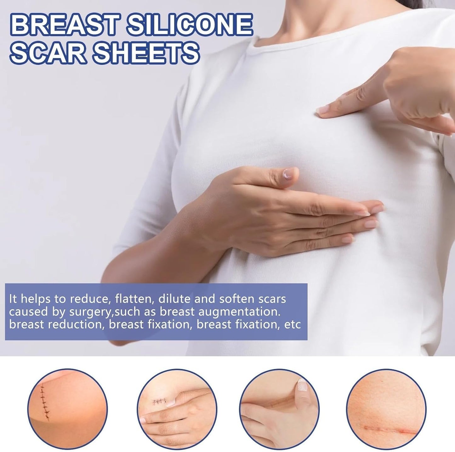 silicone scar sheets for breast scar removal, soft bands for areola, silicone anchor bands, surgical burn therapy