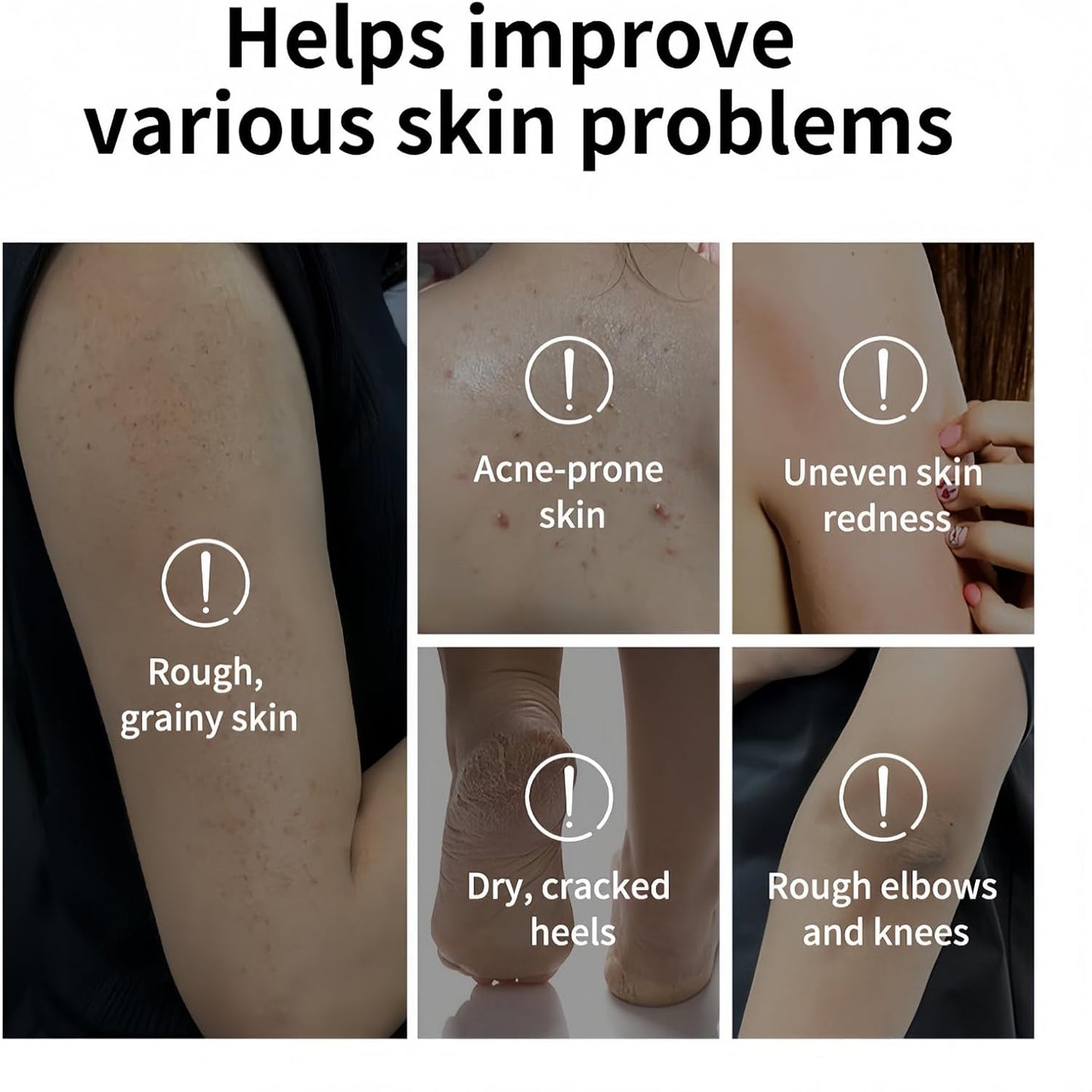 Glycolic Acid Exfoliating Body Stick, Gentle Exfoliating Body Scrub Stick, Glycolic Acid Body Scrub, Body Scrub &amp; Exfoliator for Smooth Skin, Improves Skin Texture &amp; Brightnes, Body Exfoliator