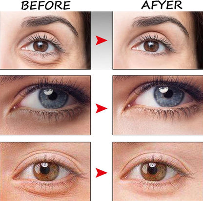 Londonget Makeup Primer for Face No-Filter Primer Instant Skin Tightener, Eye Anti Aging Serum with Massage Roller, Nourishing Relieve Loose Eye Bag Serum for Fine Wrinkles &amp; Puffiness (1pcs)
