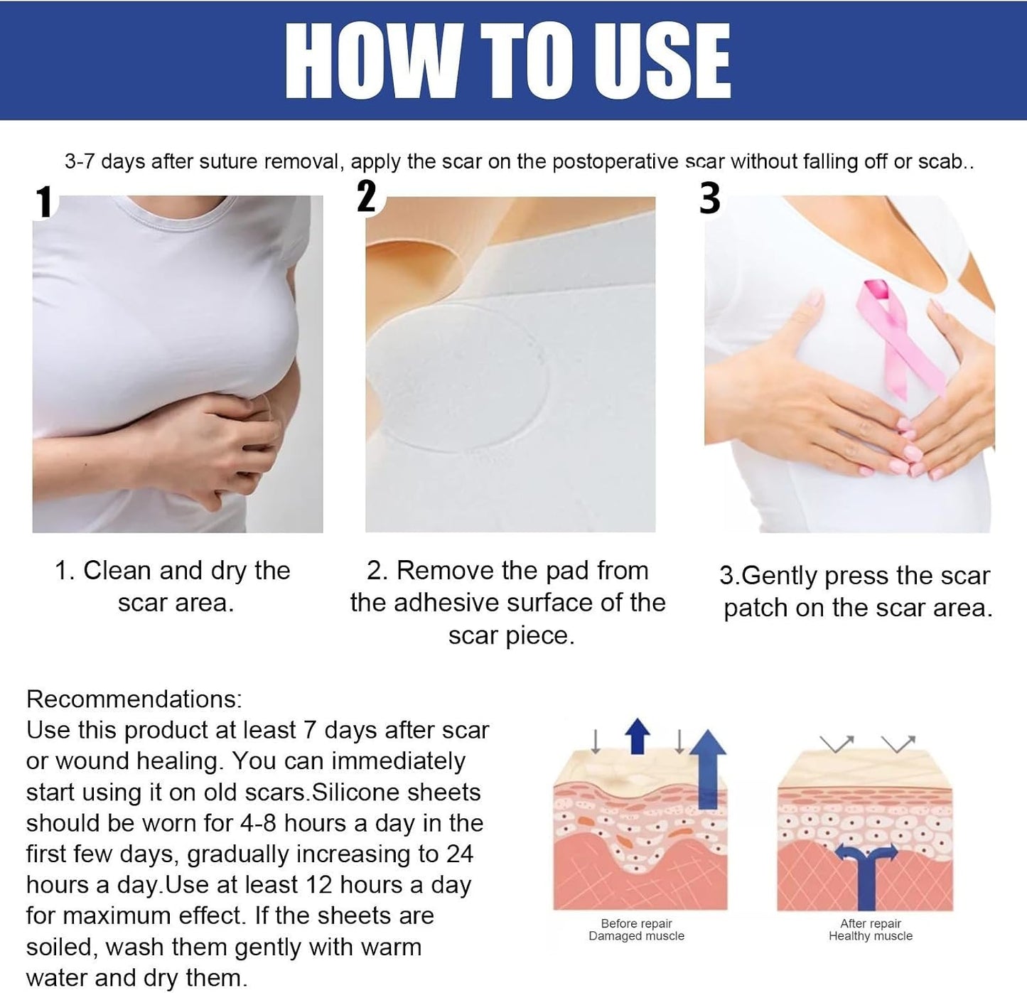 silicone scar sheets for breast scar removal, soft bands for areola, silicone anchor bands, surgical burn therapy
