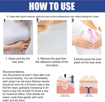 silicone scar sheets for breast scar removal, soft bands for areola, silicone anchor bands, surgical burn therapy