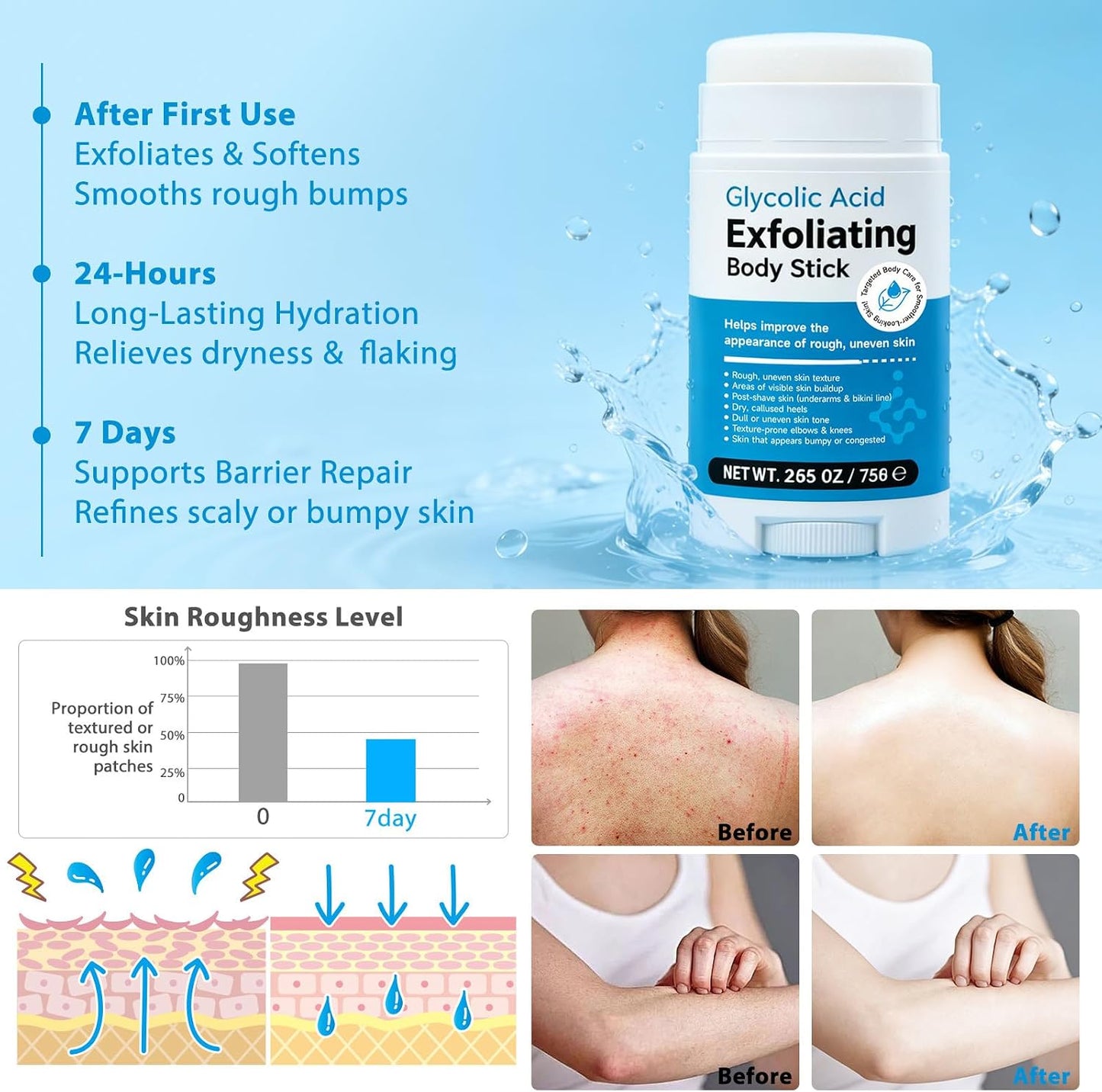 Glycolic Acid Stick, Exfoliating Body Stick with 7% AHA &amp; 0.5% BHA, For Smooth Skin on Arms, Legs, Inner Thighs &amp; Underarms, Non-Messy Solid Formula with Shea Butter