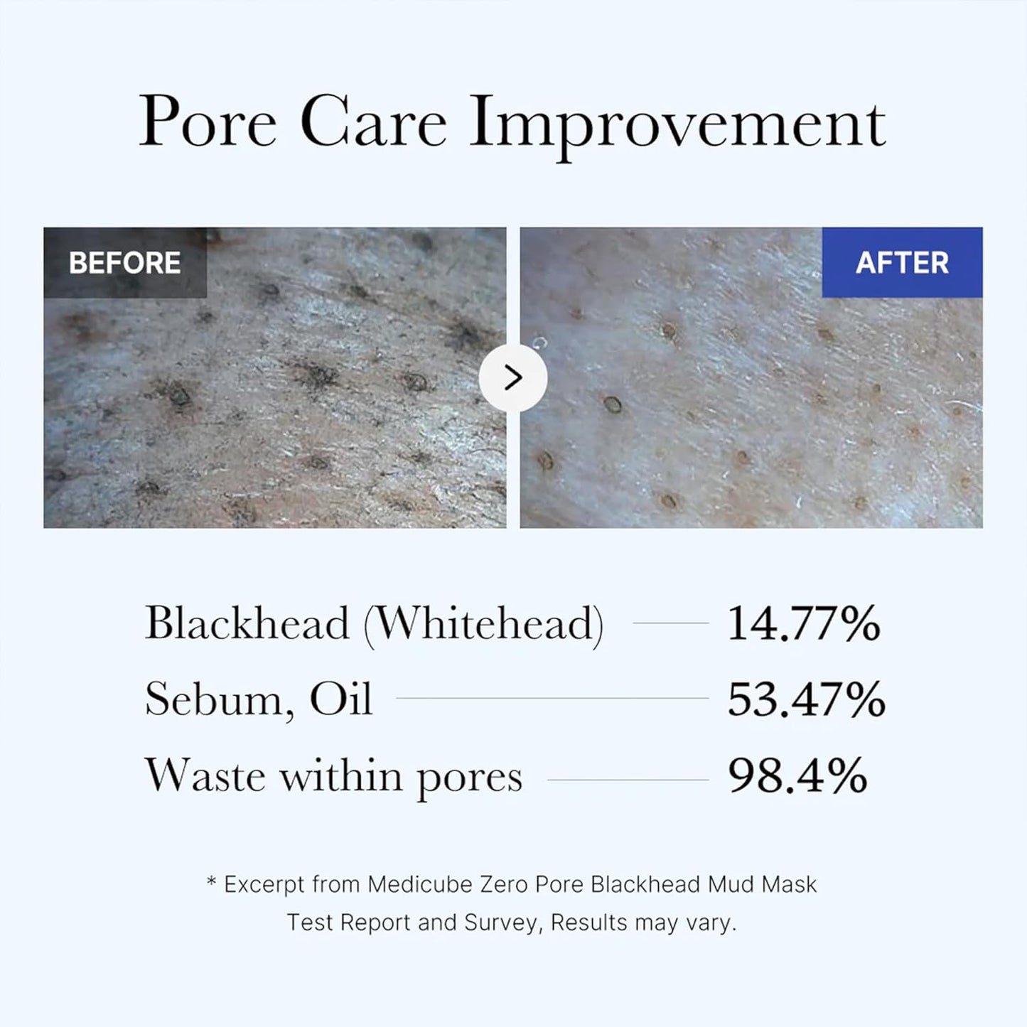 Why the medicube Zero Pore Blackhead Mud Mask Might Be Your New Skincare Shortcut