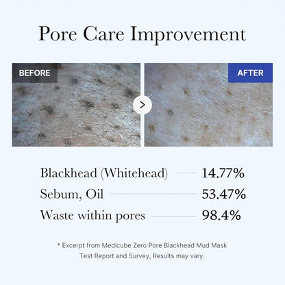 Why the medicube Zero Pore Blackhead Mud Mask Might Be Your New Skincare Shortcut