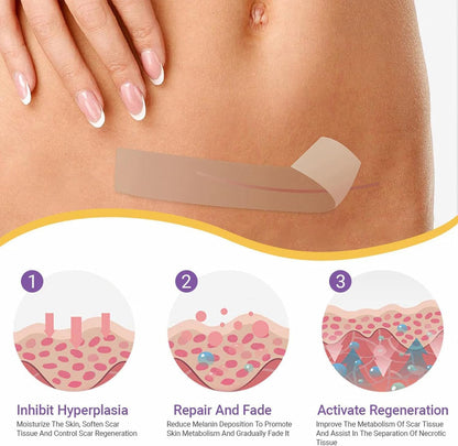 Bostore Hyaluronic Acid Nano Microneedle Repair Tape, Hyaluronic Acid Nano Repair Tape, Bostore Repair Tap, Extra Long Silicone Scar Sheets, Gentle and Skin-Friendly, Daily Care (4pcs)