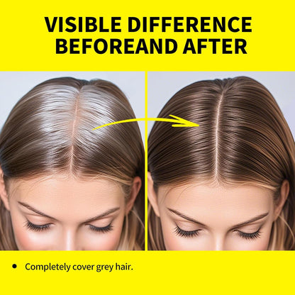Sevich Root Cover Up Stick – Instant Gray Hair Coverage, Root Repair, Natural Concealer for Hairline, Roots, and Sides for Women and Men, Plant-Based, 48H Makeup, Dark Brown