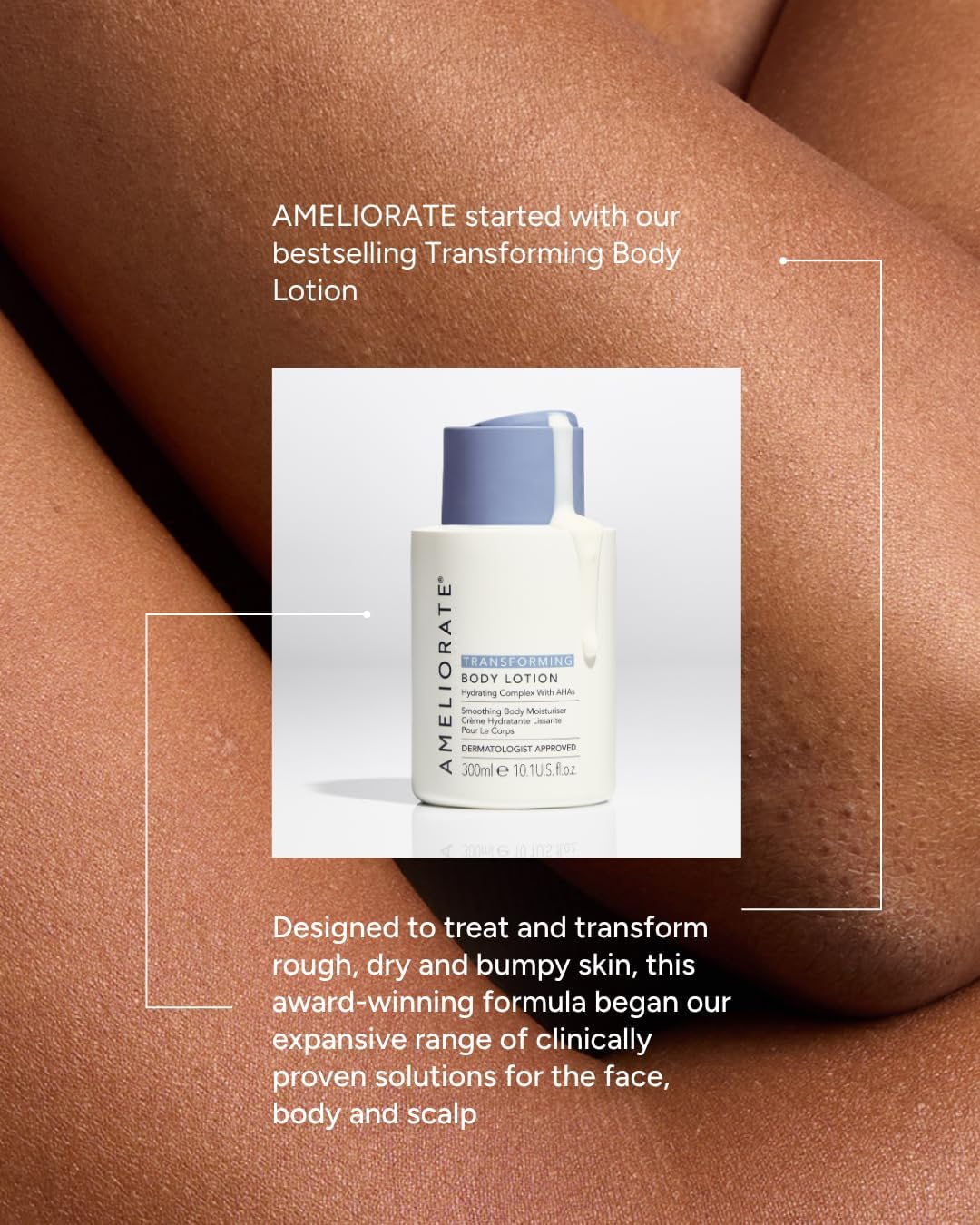 AMELIORATE Transforming Body Lotion Fragrance Free 300ml for Keratosis Pilaris (KP), Rough, Bumpy Skin &amp; Ingrown Hairs | Exfoliating Moisturiser with Lactic Acid (AHA) | Dermatologist Approved