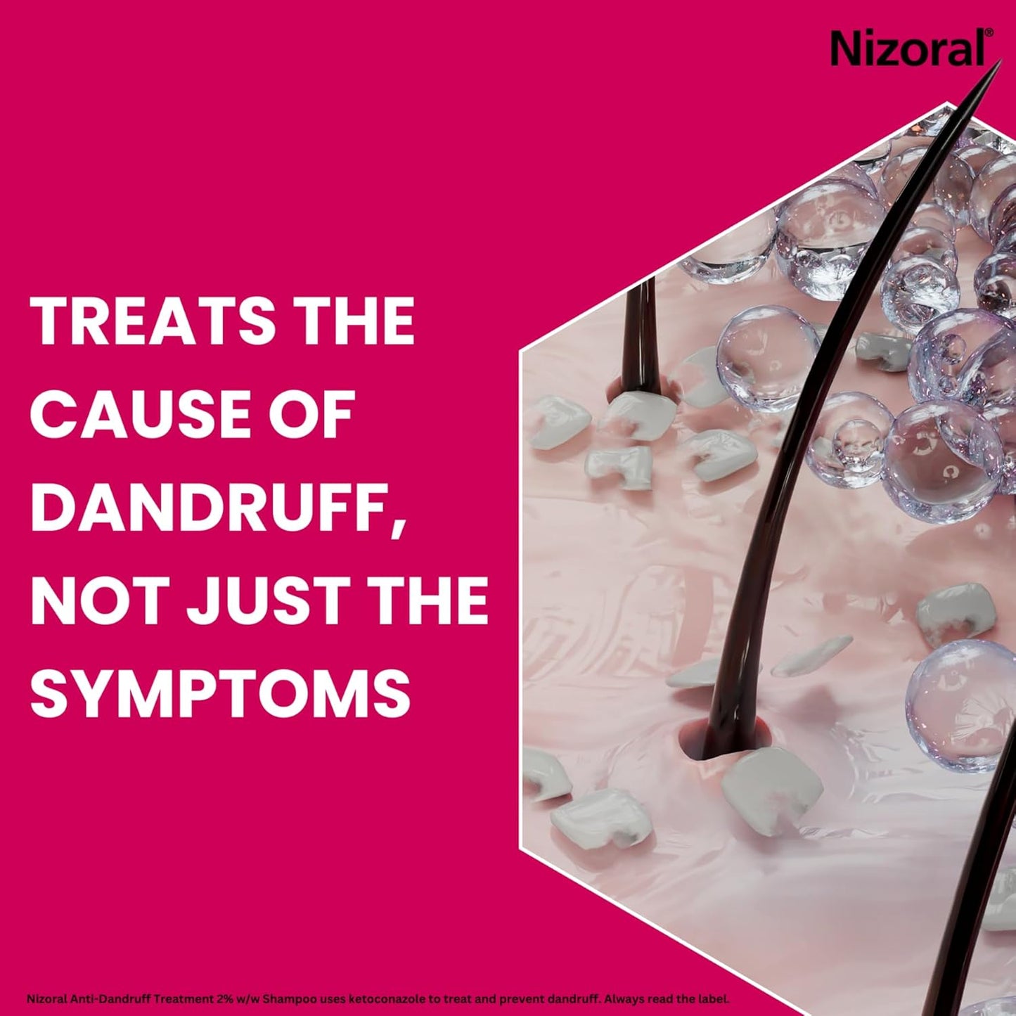 Why a Few Minutes with Nizoral Can Change Your Scalp Game