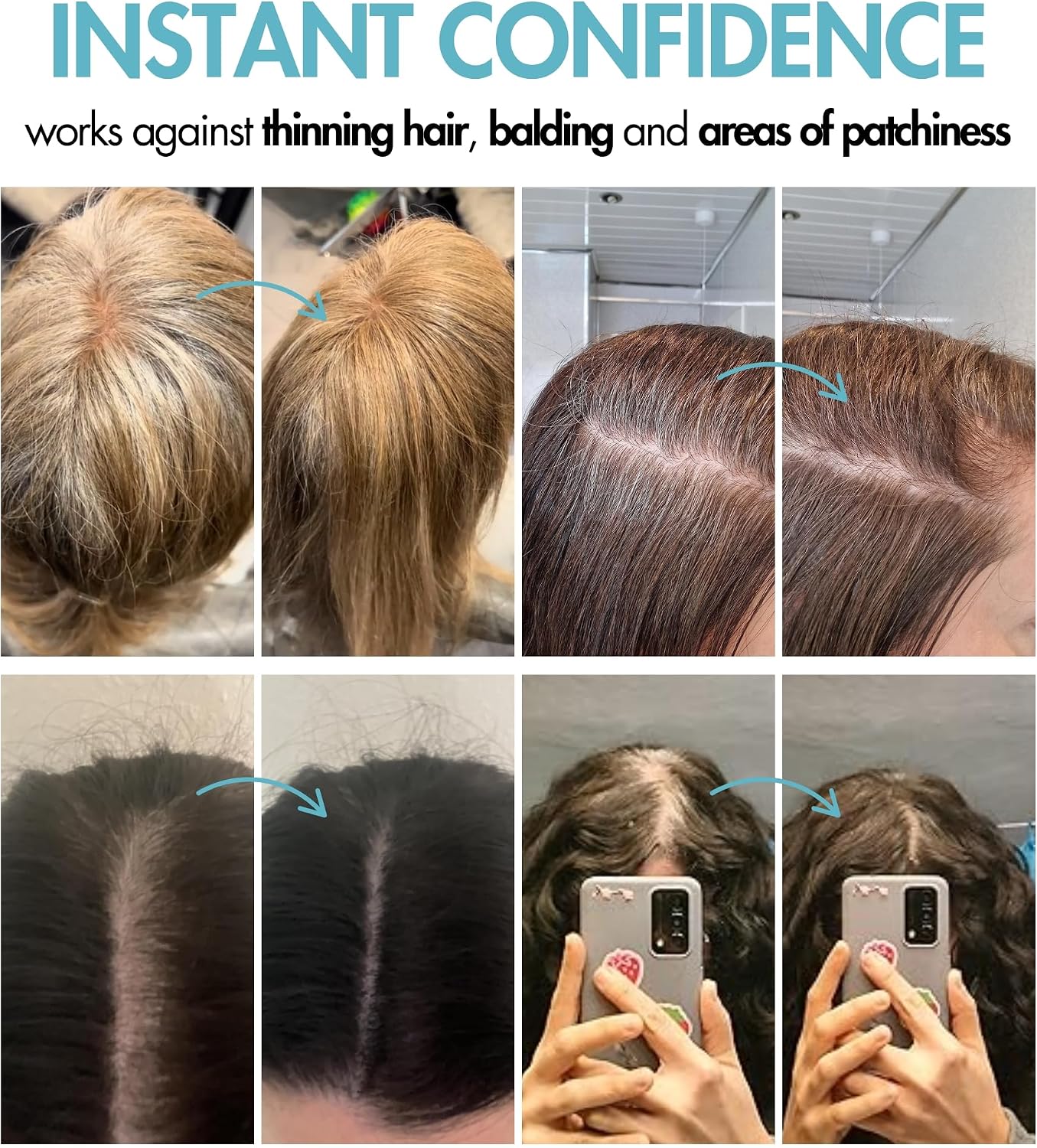 Hair Genetics Root Cover Up Dark Brown, Hide Your Grey Roots and Bald Spots Quickly and Easily, Natural Looking Root Touch Up Powder Defines and Fills in Eyebrows (Dark Brown)…