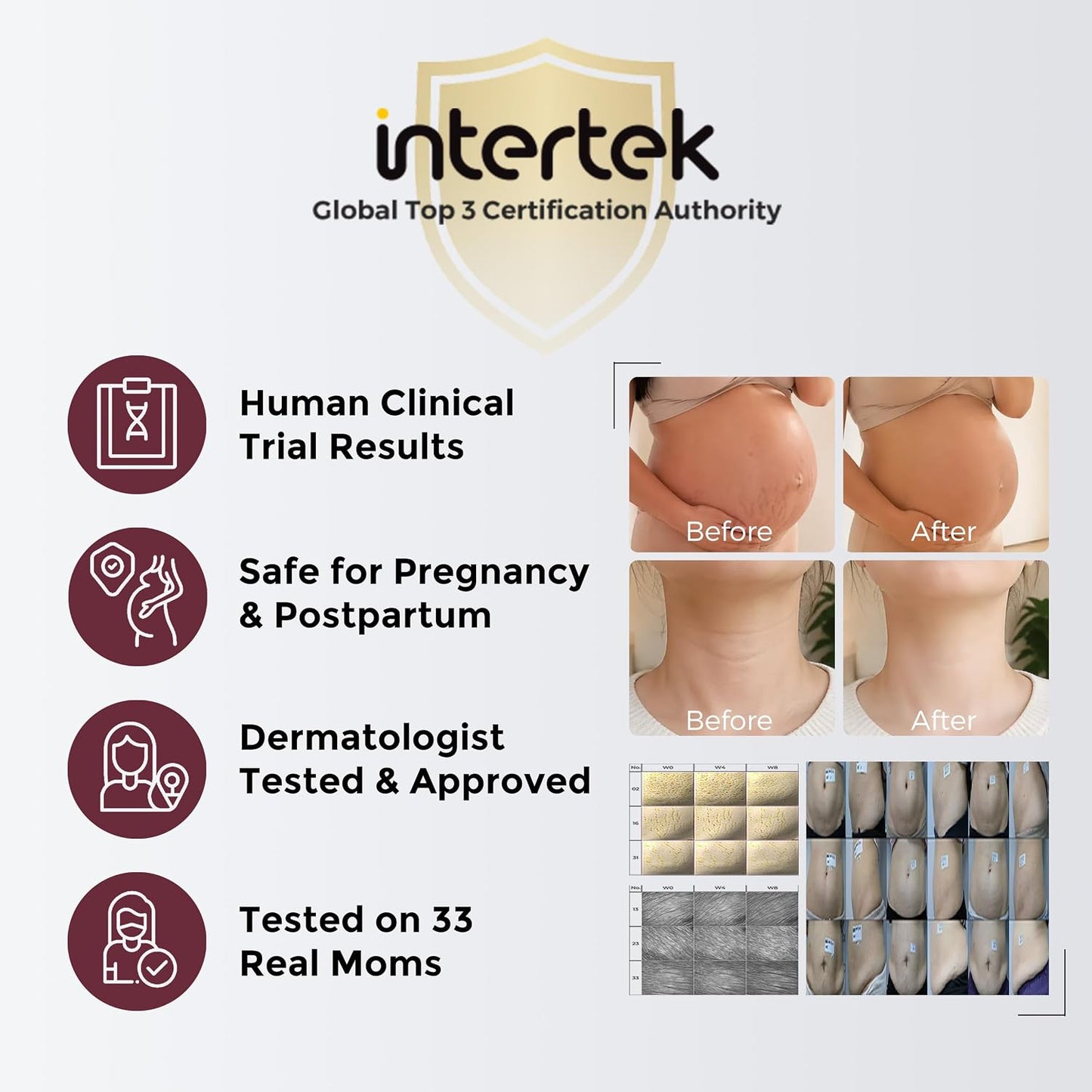 Momcozy Stretch Mark Cream for Pregnancy, Pro-Collagen Firming Moisturiser for Dry Skin, Pregnancy &amp; Postpartum, Smooths the Look of Stretch Marks, Neck Wrinkles &amp; Fine Lines, 30g
