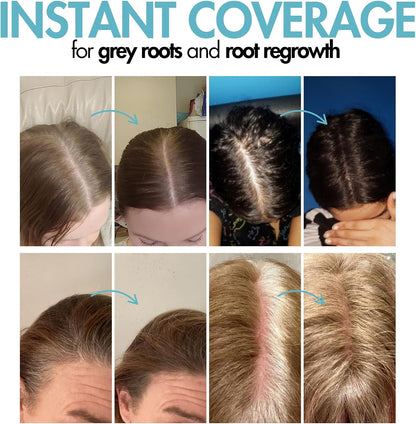 Hair Genetics Root Cover Up Dark Brown, Hide Your Grey Roots and Bald Spots Quickly and Easily, Natural Looking Root Touch Up Powder Defines and Fills in Eyebrows (Dark Brown)…