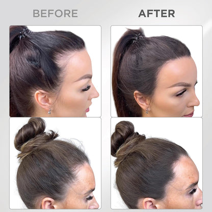THICK FIBER Root Touch Up &amp; Hairline Powder with Brush 4g – Covers Grey Roots &amp; Thinning Hair – Sweat &amp; Water Resistant – Hair Concealer for Bald Spots &amp; Fill-In (Dark Brown) for Women &amp; Men