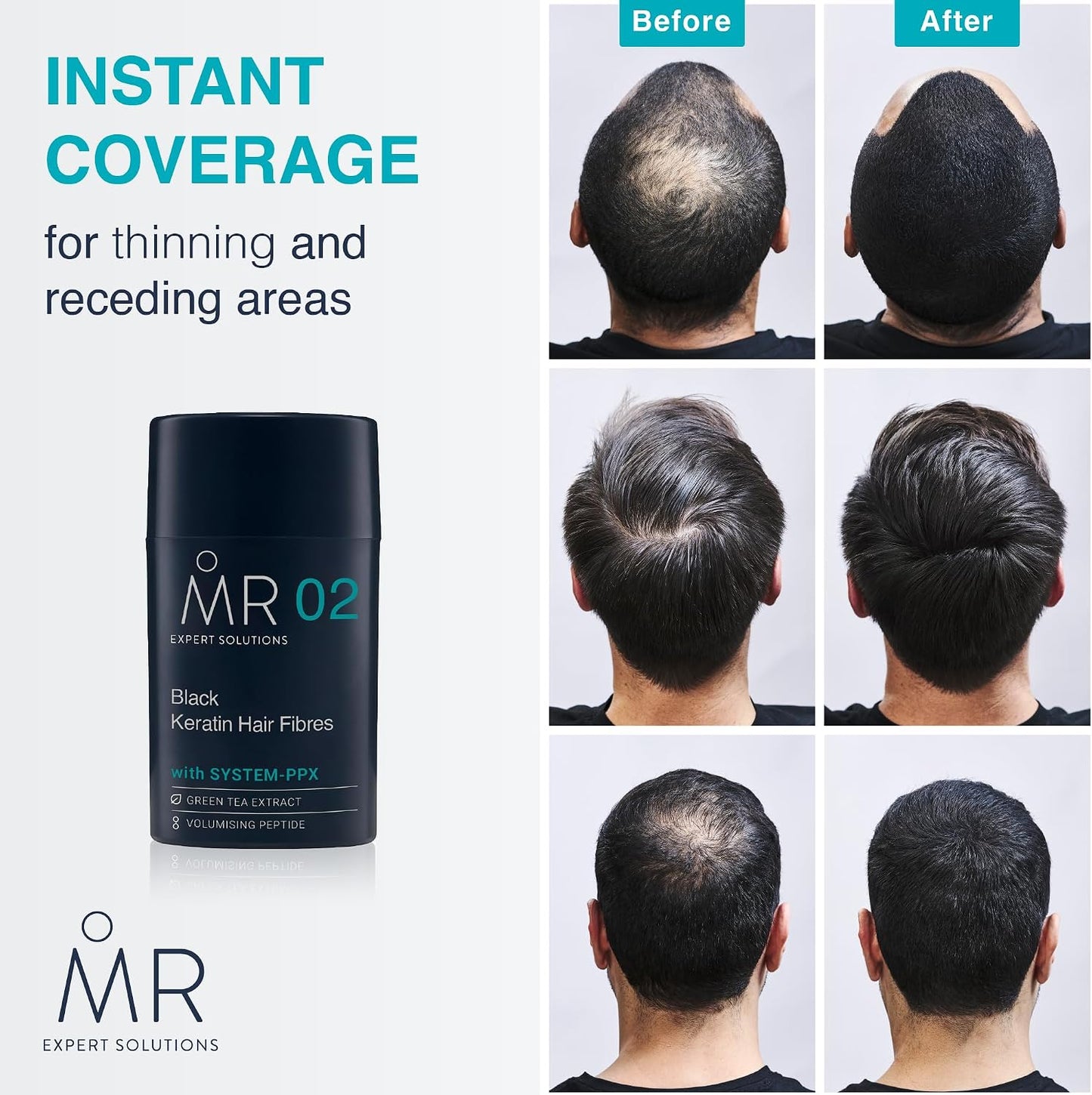 MR Hair Fibres Black 15g – Thinning Hair Concealer for Men, Instant Thickening Powder for Bald Patches, Natural Fuller Look, Keratin Formula, Paraben Free