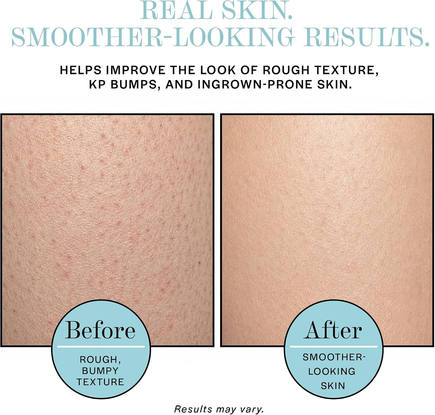 Base Laboratories Ingrown Hair - KP Bump Exfoliating Body Scrub - with AHA+BHA - Keratosis Pilaris Treatment - Daily Skin Exfoliant - Helps Reduce Strawberry Skin &amp; Razor Bumps - Men &amp; Women 90ml