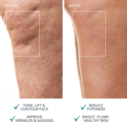 FOREO Bear 2 Body Advanced Microcurrent Body Sculpting Machine, Cellulite Massager &amp; Lymphatic Drainage, Firm &amp; Contour, Body Massager, Increases Absorption of Skin Care Products, Evergreen