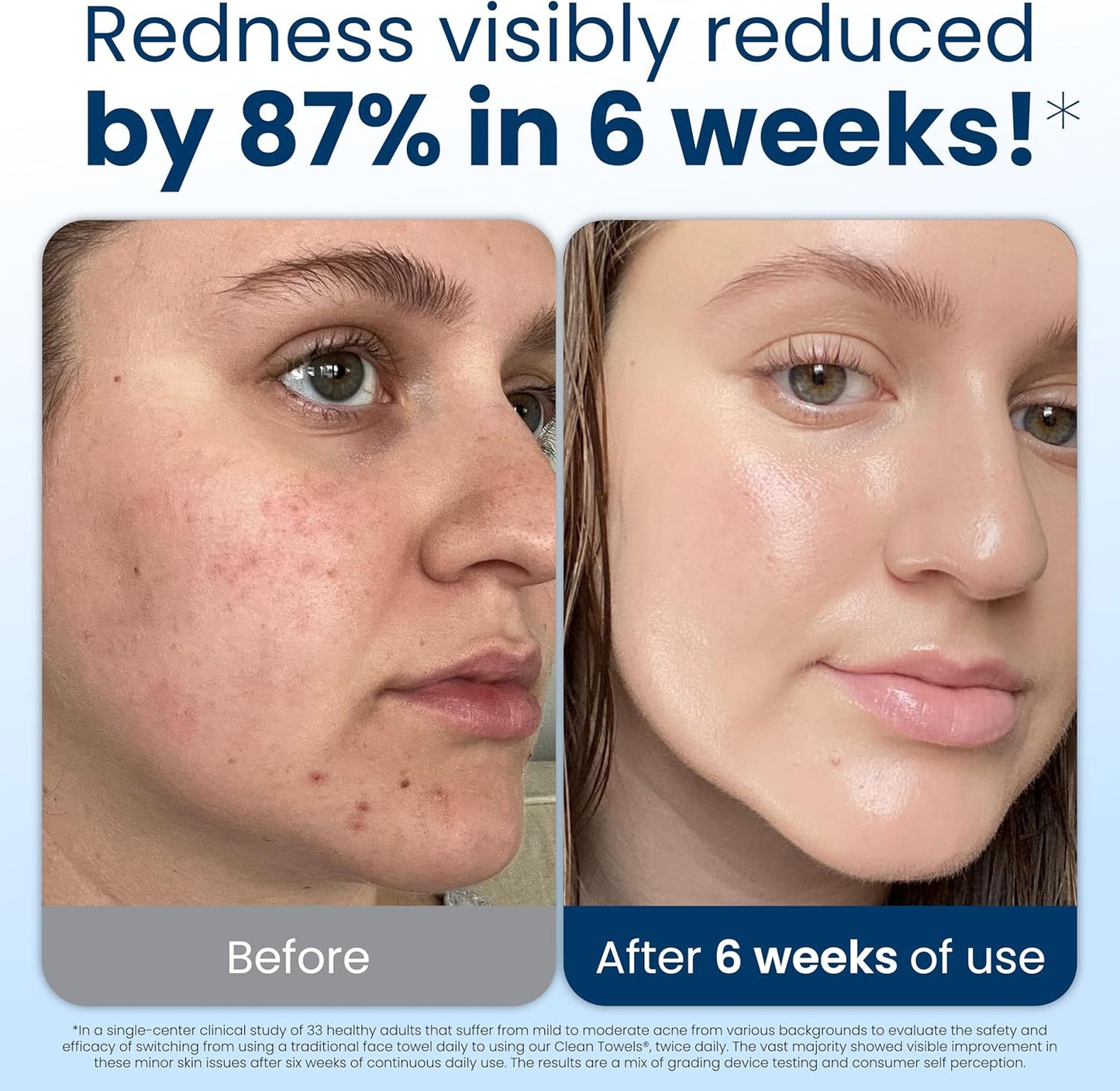 Why a Single‑Use Face Towel Might Just Change Your Skincare Routine