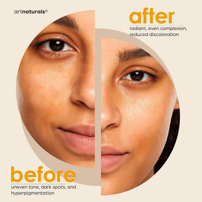 Kojic Acid Soap + African Net Sponge (2 pack X 142g Turmeric bars) Dark spot remover, Hyperpigmentation &amp; Scars - Original Japanese Complex Vitamin C, Hyaluronic Acid, retinol, shea butter (Citrus)