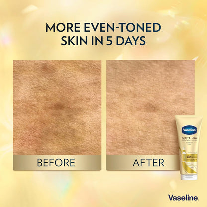 Vaseline Gluta-Hya Flawless Tone Serum Burst Lotion Moisturiser – Body Lotion with GlutaGlow™, Glycerol, Hyaluron &amp; Antioxidants 10x Stronger Than Vitamin C*, Reduces Dark Spots in 5 Days 200ml