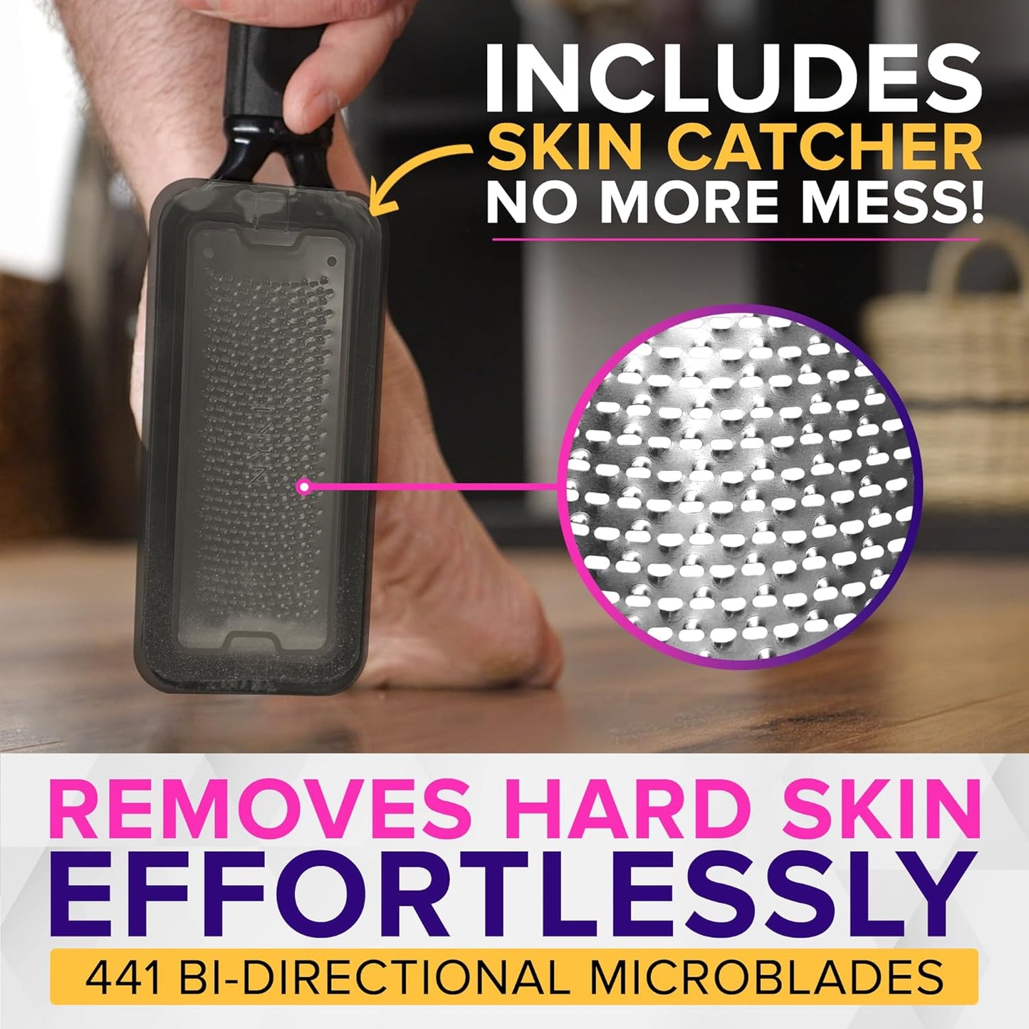 NYK1 MegaFile: The No‑Mess, No‑Electric Callus Fix You Didn’t Know You Needed