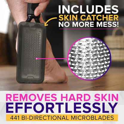 NYK1 MegaFile: The No‑Mess, No‑Electric Callus Fix You Didn’t Know You Needed