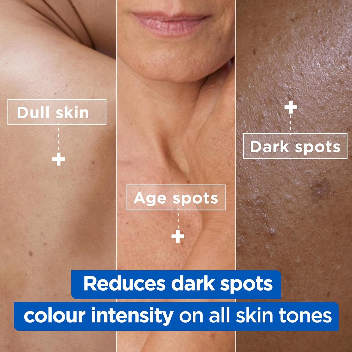 Mixa Cream, Niacinamide Bright Moisturizing Anti-Dark Spot Cream, Body Care Dark Spot Corrector for Uneven Tone, with 9% Niacinamide, Shea Butter &amp; Vitamin C, 400ml