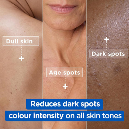 Mixa Cream, Niacinamide Bright Moisturizing Anti-Dark Spot Cream, Body Care Dark Spot Corrector for Uneven Tone, with 9% Niacinamide, Shea Butter &amp; Vitamin C, 400ml