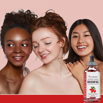 Rosehip Oil for Face, Skin 120ml, 100% Pure Cold Pressed Natural, Unrefined, Hydrating, Nourishing &amp; Moisturising Carrier Oil, Organic Rose hip Seed Oil for Skin, Nails &amp; Hair