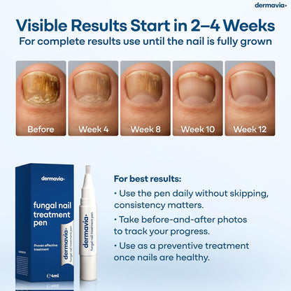 Why DERMAVIA+ Might Just Be the Nail‑Care Sidekick You’ve Been Waiting For