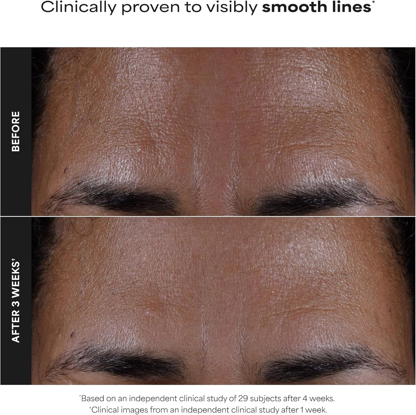 Paula's Choice SKIN PERFECTING 2% BHA Liquid Exfoliant - Face Exfoliating Peel Fights Blackheads &amp; Enlarged Pores - for a Healthy Glow - with Salicylic Acid - Combination &amp; Oily Skin - 30 ml