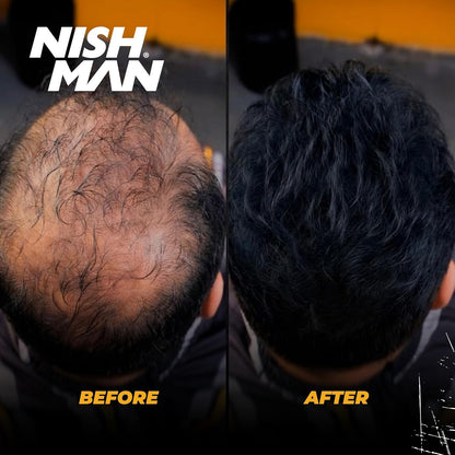 NISHMAN Enhance Hairline Powder – Black 10g – Hairline Filler for Men – Conceals Hair Gaps and Thinning Areas – Adds Natural Density and Sharp Definition – Lightweight, Smudge-Free Formula