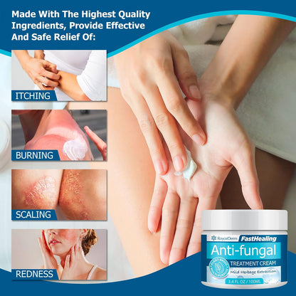 Roycederm Antifungal Treatment Cream for Skin: Anti-Fungal Cream for Jock Itch, Ringworm, Athlete's Foot &amp; Rash Relief - Strong Fungal Care for Men &amp; Women - Gentle Formula for Itchy Skin &amp; Tinea