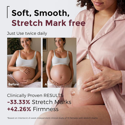 Momcozy Stretch Mark Cream for Pregnancy, Pro-Collagen Firming Moisturiser for Dry Skin, Pregnancy &amp; Postpartum, Smooths the Look of Stretch Marks, Neck Wrinkles &amp; Fine Lines, 30g