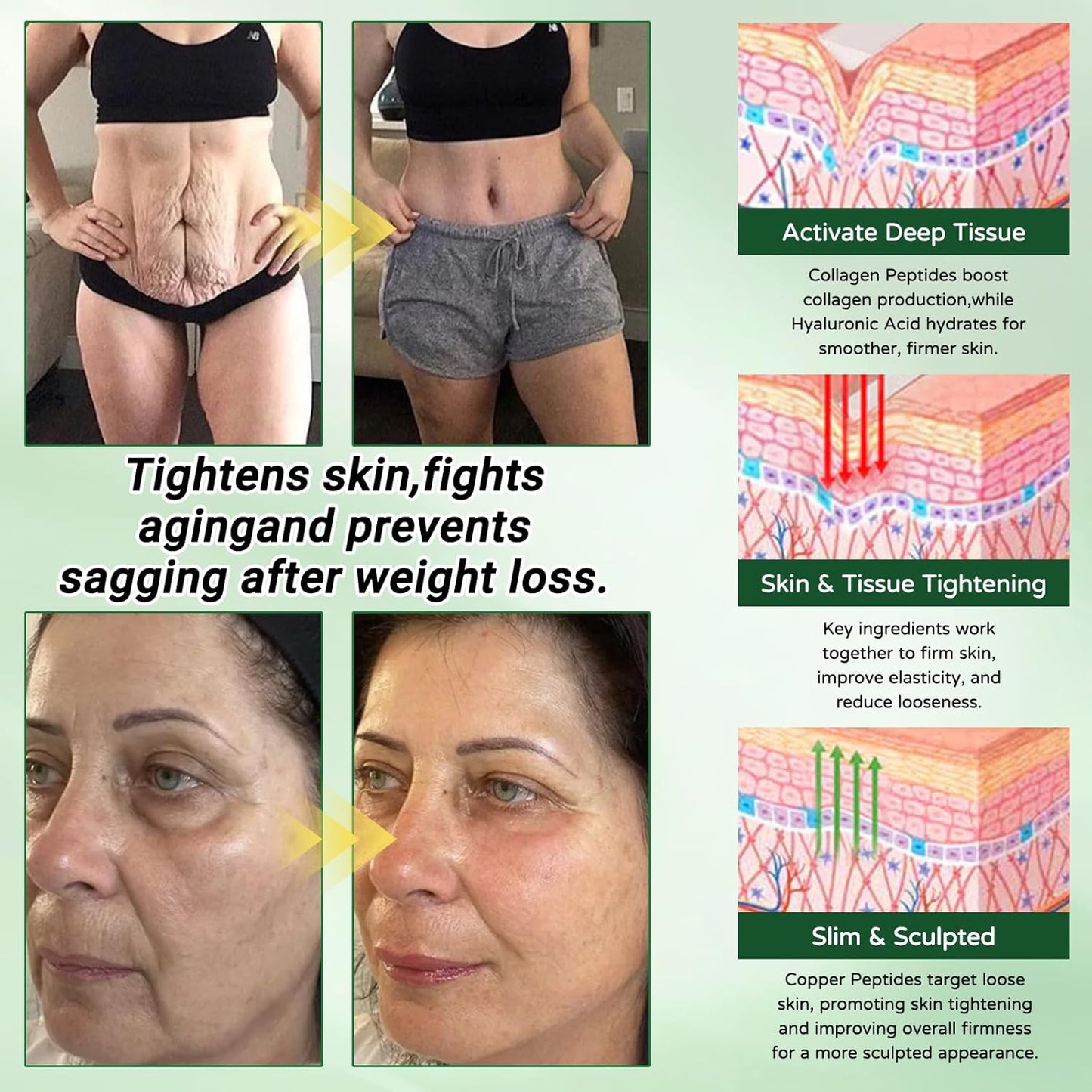 Luxarise Moringa 10-IN-1 Advanced Nano Microneedle Patch, 7Pcs/Pack Weight Loss Patches, Luxarise Moringa Patches, Gentle Soothing, for Women &amp; Men (6 Packs)