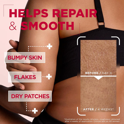 Mixa Body Cream, Urea Cica Repair Renewing Cream, Body Moisturiser for Dry, Rough, Bumpy Skin, with 10% Urea and Niacinamide, Hypoallergenic, Up To 100H Hydration, 400ml