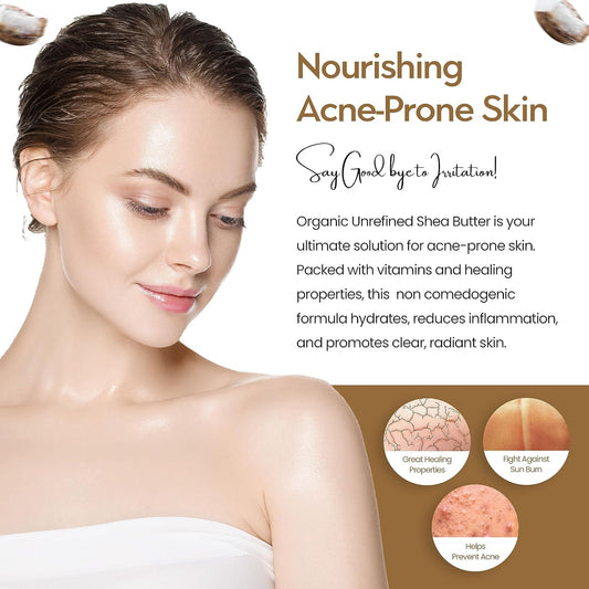 Freshskin Beauty LTD | 1KG Shea Butter Certified Organic - Unrefined, Cold Pressed, 100% Pure, Raw &amp; Natural (1000g)